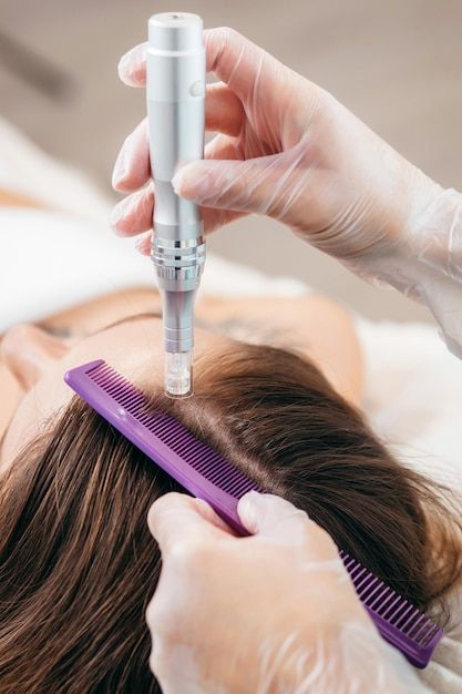 Hair Microneedling